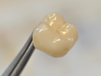 Döring Dental Technik 